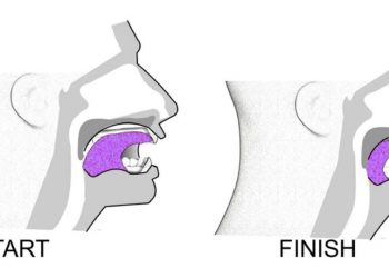 มาออกกำลังกาย บริหารลิ้น ลดภาวะหยุดหายใจตอนนอน (Sleep Apnea) กัน