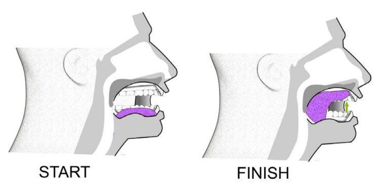 E2 มาออกกำลังกาย บริหารลิ้น ลดภาวะหยุดหายใจตอนนอน (Sleep Apnea) กัน 2
