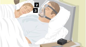 สายรัดหน้ากาก CPAP (Headgear)