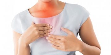 กรดไหลย้อน