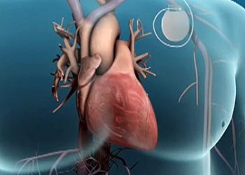 นอนกรน อันตรายจริงไหม ภาษาอังกฤษ หยุดหายใจตอนนอน5