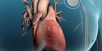 นอนกรน อันตรายจริงไหม ภาษาอังกฤษ หยุดหายใจตอนนอน5